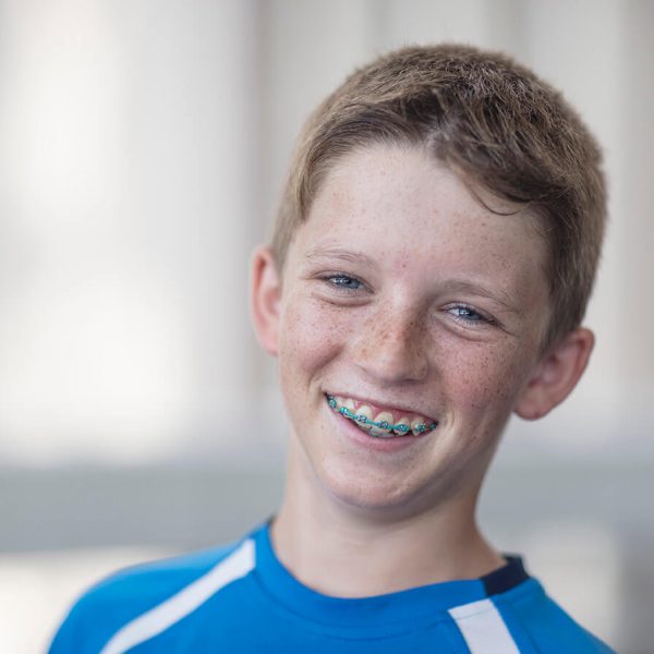 portrait-of-smiling-boy-with-braces-2022-12-16-22-26-26-utc (1)